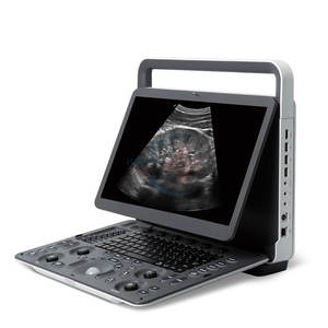 Portatil <span class=keywords><strong>Ultrasound</strong></span> Calcul automatique Système à ultrasons <span class=keywords><strong>Machine</strong></span> à ultrasons vétérinaire - Product Image 1