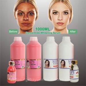 Suero Concentrado Sepi OEM 1L, Blanqueador, Antiarrugas, Cuidado de la Piel, Elimina Manchas, Ácido Kójico, Iluminador Facial para Manchas Oscuras - Product Image 1