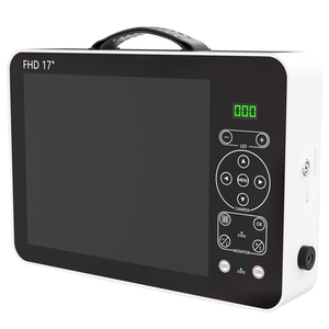 Nhà máy tùy chỉnh phẫu thuật 17 inch Full HD nội soi Hệ thống camera nội soi soi cystoscope towerendoscope Hệ thống camera Ent - Product Image 6