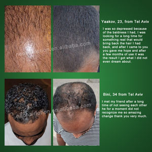 Cabelo selvagem Crescimento Orgânico Óleo Balde <span class=keywords><strong>Anti</strong></span> Perda De Cabelo Tratamento para a Calvície Neo Loção Cabelo 120ml - Product Image 4