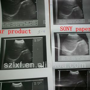 High Quality Customized FOISON F908 UPP-110HG UPP 110S ISO9001 Certified High Definition Ultrasonic Thermal <b>Paper</b> <b>Roll</b> for - Product Image 6