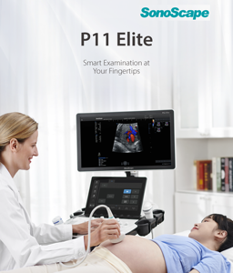 Sonoscape P11Elite 4D/5D Trolley Máquina <span class=keywords><strong>de</strong></span> ultrasonido Doppler a color <span class=keywords><strong>para</strong></span> venas, bebé, abdomen - Product Image 2