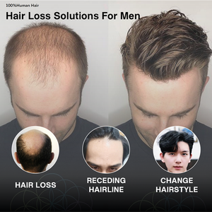 Tupé Masculino con Base de Seda, <span class=keywords><strong>Pelucas</strong></span> de Cabello Humano, Topper <span class=keywords><strong>para</strong></span> <span class=keywords><strong>Hombres</strong></span> <span class=keywords><strong>Jóvenes</strong></span>, <span class=keywords><strong>Pelucas</strong></span> Cortas <span class=keywords><strong>para</strong></span> <span class=keywords><strong>Hombres</strong></span> - Product Image 2