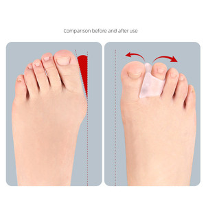 Séparateur d'orteils en SEBS souple et lavable, correcteur d'<span class=keywords><strong>hallux</strong></span> <span class=keywords><strong>valgus</strong></span>, anti-frottement, redresseur d'orteils superposés <span class=keywords><strong>pour</strong></span> les soins des pieds (vente en gros) - Product Image 2