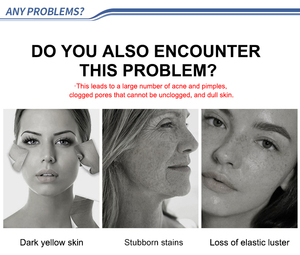 Kit di Biomicroneedling con Peeling alle alghe calde spugnole Spicules spugnole spugnose Peeling <span class=keywords><strong>età</strong></span> sfidando le alghe microcristalline Kit B - Product Image 4