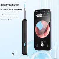 Caméra Otoscope Visuelle Sans Fil WiFi, Kit de Nettoyage Intelligent pour Oreilles, Outil Portable d'Extraction de Cérumen, 6 Lumières LED, Charge en Moins d'1 Heure, CHIPAI