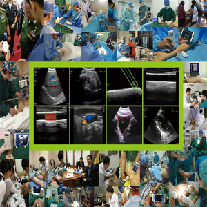 <span class=keywords><strong>Ultrasound</strong></span> genggam untuk bedah neuroskopik lesi, penempatan Shunt & Drainase Hematoma - Product Image 2