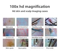 Hydro Dermabrasie Professionele Hydra Aqua Peel 10-in-1 H2O2 Gezichtsmachine Zuurstof Aqua Peel Machine