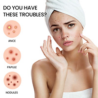 Étoiles Anti-Acné Colorées Vente Chaude, 200 Pièces – Patchs Efficaces contre Boutons et Acné