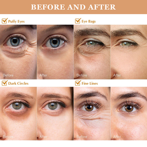 Soins de la peau biologiques anti-âge, éliminer les poches sous les yeux, les cernes, rétinol, collagène, hydratant, patch anti-rides pour les yeux - Product Image 3