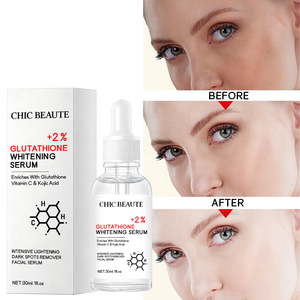 CHIC BEAUTE - Suero Facial con Glutatión, Ácido Kójico y Vitamina C, Esencia Facial Aclarante, Suero Blanqueador para el Cuidado de la Piel del Rostro, para Eliminar <span class=keywords><strong>Manchas</strong></span> Oscuras - Product Image 4
