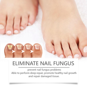 Pluma reparadora de uñas, hidrata suavemente la reparación de manos y pies, tratamiento de uñas fúngicas, cuidado de los pies - Product Image 6