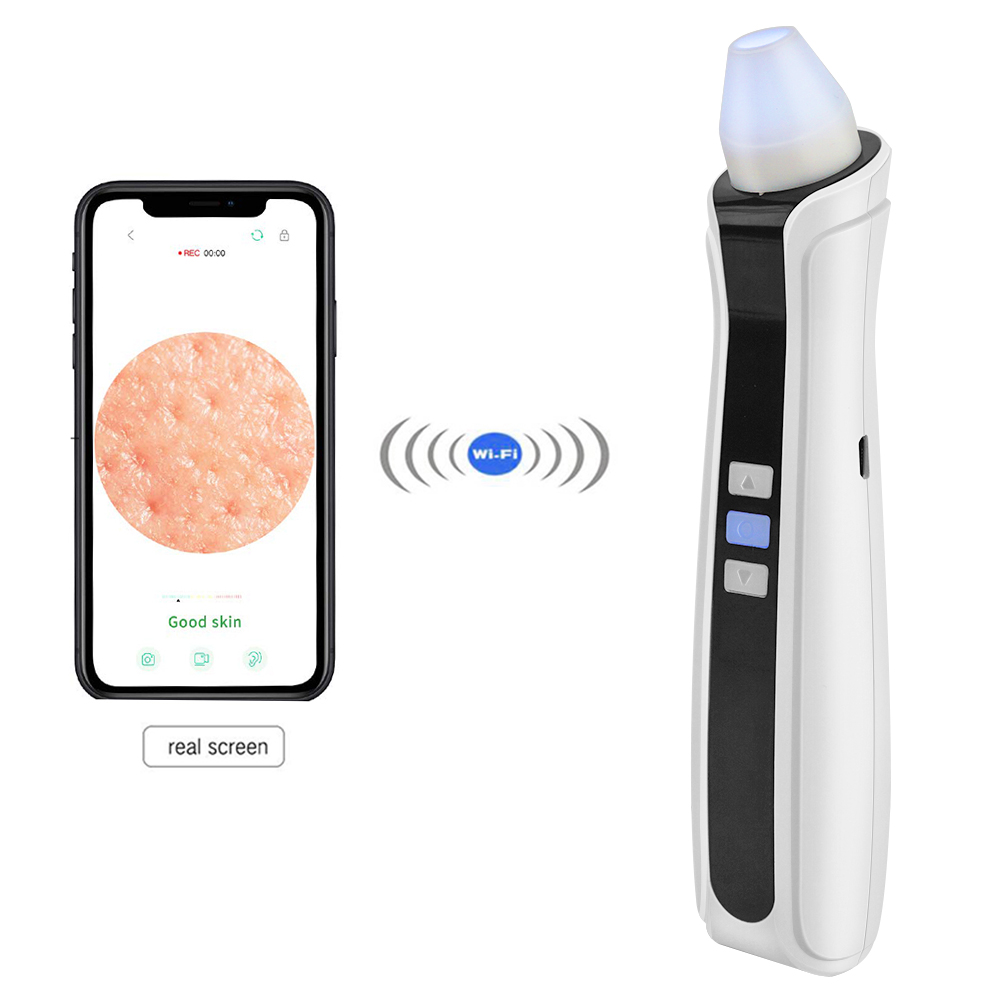 Thuis Schoonheid Huidverzorging Wifi 500X Microscoop Visuele Vacuüm Comedondrukker Met Camera