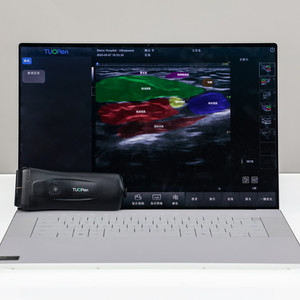 Máy siêu âm Doppler màu mini cầm tay, máy siêu âm cầm tay, đầu dò tuyến tính siêu âm 3D - Product Image 2