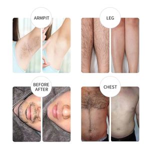 Cire dépilatoire bio Lifestance en marque blanche, 100g, 300g, 500g, 1000g, perles dures, anti-allergie, pour visage et zones sensibles - Product Image 6