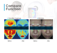 Escáner facial completo MC10, equipo analizador de piel, tecnología AI para análisis de problemas faciales, características hidratantes, EU IT JP US ZA