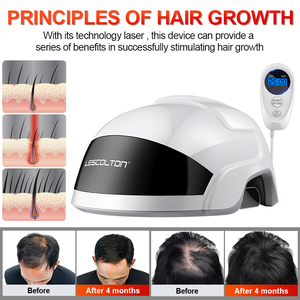 Lescolton Factory Wholesale Home LLLT 650nm <strong>Hair</strong> Regrowth Machine 56 Diodes <strong>Hair</strong> Cap <strong>Best</strong> <strong>Hair</strong> Growth <strong>Laser</strong> <strong>Helmet</strong> - Product Image 4
