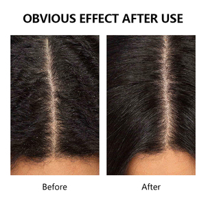 Siero per il Cuoio Capelluto OEM Redensyl Senza Risciacquo, Trattamento Peptidico per la Densità dei Capelli, Siero per la Crescita dei Capelli per Uomini e Donne - Product Image 4