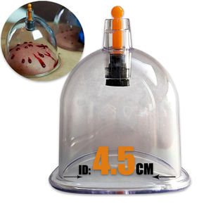 9 tailles, 2000 MIX Ventouses de Hijama chinoises, instruments de thérapie par ventouses, anti-cellulite, ventouses pour massage - Product Image 1
