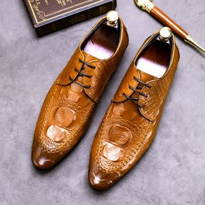 Zapatos de Hombre Personalizados, Formales, Casuales, Elegantes, Sin Cordones, Impermeables, para Boda, Resistentes al Agua - Product Image 6