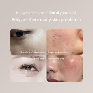 Digital Skin Moisture Tester LC Display portátil Skin Analyzer recarregável água óleo Tester análise umidade medidor caneta - Product Image 4