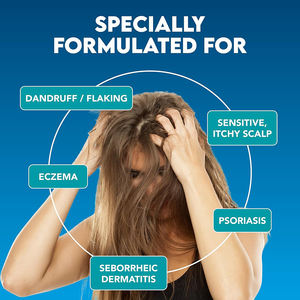 Traitement rapide du démangeaisons du cuir chevelu sec, spray hydratant pour le cuir chevelu, traitement rafraîchissant des démangeaisons du cuir chevelu pour les peaux sensibles et le <span class=keywords><strong>psoriasis</strong></span> - Product Image 2