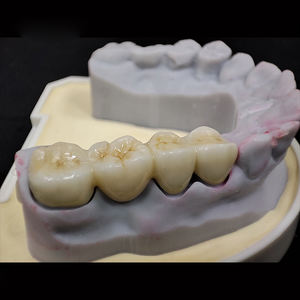 <span class=keywords><strong>Dents</strong></span> en zircone personnalisées de laboratoire dentaire numérique en Chine couronne et ponts en zircone solide - Product Image 4