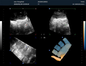 Dawei <span class=keywords><strong>Sonogram</strong></span> mesin peralatan dokter hewan hewan warna <span class=keywords><strong>Doppler</strong></span> Ultrasound untuk domba dan anjing Ultrasound - Product Image 5