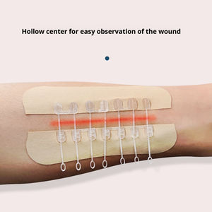 מתח רפואי-הפחתת רוכסן נטול תפרי-סוג צלקת עור ללא רוכסן עבור פצעי ניתוח בלוטת התריס - Product Image 5