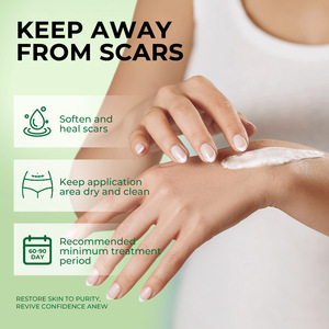Crema Corporal para Cicatrices de 30g, para Hidratar y Cuidar la Piel con Extracto de Aloe Vera, para Adultos - Product Image 3