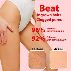 Exfoliante Corporal Blanqueador e Iluminador con Ácido Kójico, Vitamina C, AHA y BHA para Axilas, Entrepierna, Área Íntima y Zona del Bikini - Product Image 4