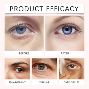 Crème pour les yeux au peptide rose certifiée MSDS personnalisée 30g pour raffermir la zone des yeux, atténuer les ridules, améliorer les cernes et réduire les poches sous les yeux - Product Image 4