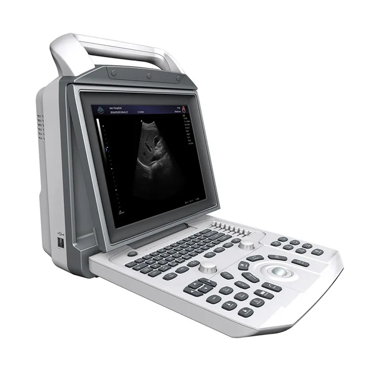 Flo MSL-scanneur médical à ultrasons, chariot Portable, noir et blanc, Instruments à ultrasons B/W
