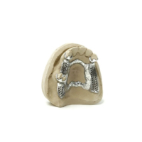 Recherche de distributeurs pour imprimante 3D dentaire PRS-M100 OEM, imprimante 3D métallique pour supports d'implantation dentaire