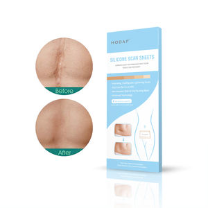 Feuilles de gel de silicone réutilisables, issues directement de l'usine, pour l'élimination des cicatrices chirurgicales - Product Image 4