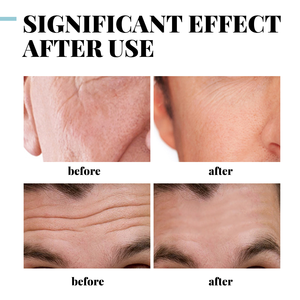 Crème <span class=keywords><strong>Visage</strong></span> Homme Naturelle Anti-Acné et Anti-Taches OEM/ODM à Marque Privée au Collagène et Acide Hyaluronique - Product Image 3