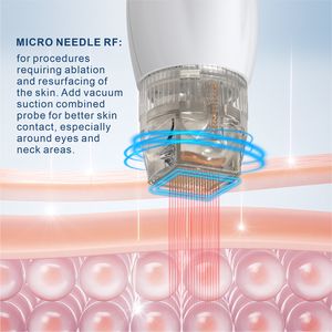 Prix Usine Nouveautés Appareil de Beauté 2-en-1 <span class=keywords><strong>à</strong></span> <span class=keywords><strong>Radiofréquence</strong></span> <span class=keywords><strong>Fractionnée</strong></span> Or pour Raffermissement Cutané, Anti-rides et Lifting Facial, avec Fonction Froid - Product Image 3