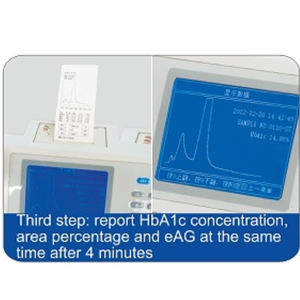 HB661 Full-auto Glycated Hemoglobin <strong>HbA1C</strong> Analyzer Laboratory Equipment Clinical Analytical Instruments - Product Image 4