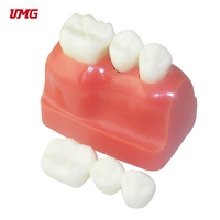 Dentiste dentaire Modèle de Dents De Démonstration D'implant L'analyse Couronne Pont bon