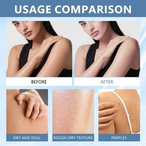 カスタマイズ可能なソフト保湿ボディケアパッチ NAD+強化栄養配合 肌を落ち着かせる 卸売潤滑ボディパッチ - Product Image 5