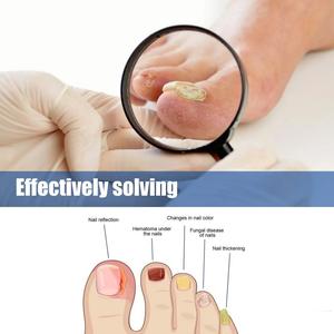 Commercio all'ingrosso di liquido antibatterico <span class=keywords><strong>per</strong></span> <span class=keywords><strong>unghie</strong></span> brillanti grigio nail medicine a base di erbe antibatterico agente <span class=keywords><strong>per</strong></span> <span class=keywords><strong>unghie</strong></span> luminose - Product Image 4