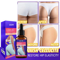 Huile Essentielle d'Ail pour l'Augmentation des Hanches et des Fesses - Efficace pour l'Amélioration des Fesses - Offre Spéciale