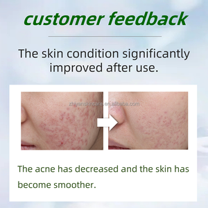 Bubuk Lyophilized pemutih Microneedle, spons ganggang jarum tulang hijau biologi untuk wajah jerawat & kulit bintik pengupas - Product Image 3