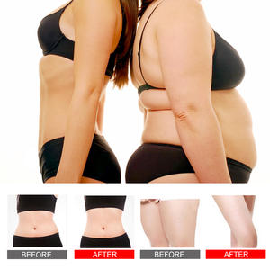 Crema Reductora Anticelulitis con Vitamina C, 100% Extractos Herbales, Nueva Fórmula para el Cuerpo - Product Image 4