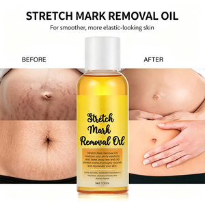 Aceite para Eliminar Estrías Arresal al por Mayor, 100 ml, Vitamina E Natural, Restaura la Elasticidad de la Piel, Atenúa Estrías Nuevas y Antiguas - Product Image 6