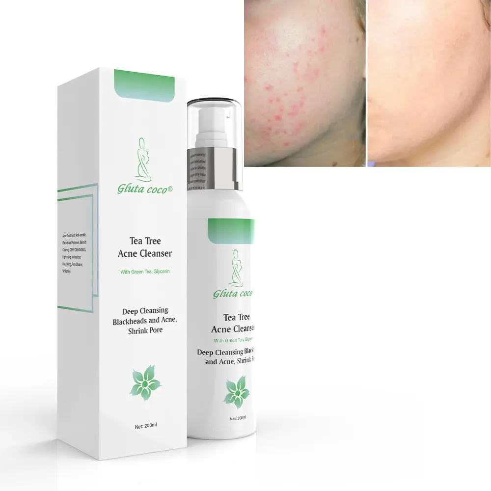 Private Label Natuurlijke Tea Tree Acne Reiniger Whitening Voedende Verlichting Diep Reinigende Huidverzorging Gezichtsverzorging Reiniger