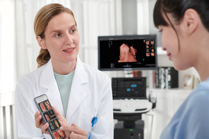 Sonosbape P12 elite ecografo doppler, sistem diagnostik <span class=keywords><strong>ultrasound</strong></span> digital dengan panduan transduser biopsi, peralatan rumah sakit - Product Image 4