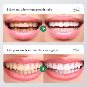 Haute qualité bicarbonate de soude niacinamide blanchissant élimination du jaunissement soin des gencives dentifrice frais dentifrice oral