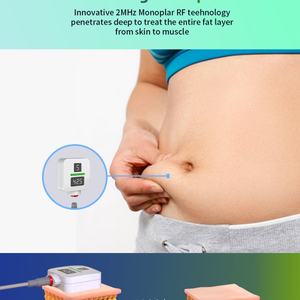 Máquina Reductora de Grasa Abdominal, Equipo Deportivo para Quemar Grasa, Dispositivo para Reducir Grasa Abdominal - Product Image 3