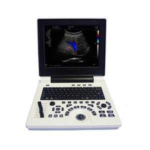 Ultrasoonapparatuur voor dieren, dierenartsen-echografieapparaat, ecografo scanner, dierenartsen-echografieapparaat - Product Image 2